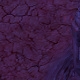 Tile[-11:-18]