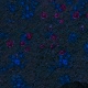Tile[-2:8]