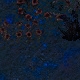 Tile[11:-4]