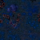 Tile[20:-7]